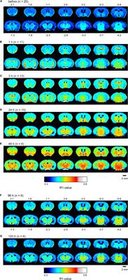 Manganese Dynamics in Mouse Brain After Systemic MnCl2 Administration for Activation-Induced Manganese-Enhanced MRI